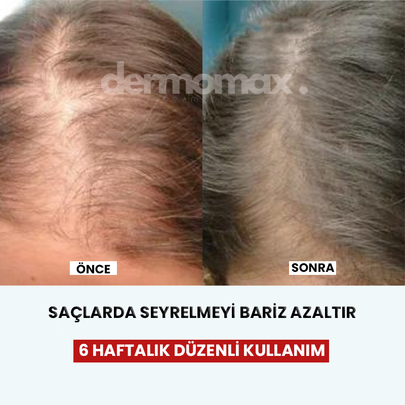 Ragenos ScalpGlow serum uygulama haznesi