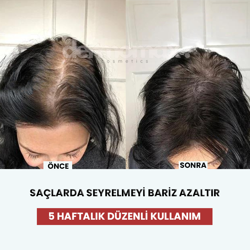 Ragenos ScalpGlow kırmızı ışık ve masaj özelliği