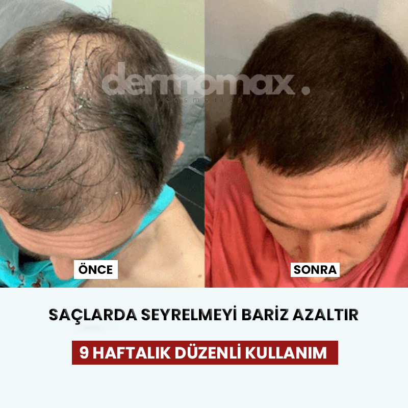Ragenos ScalpGlow saç derisi bakım tarağı detay görseli